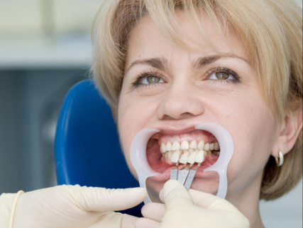 Dental Implants Glendale Center