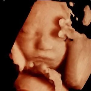 Best 3D, 4D, & HD Ultrasound Services Chicago - Tummy Vision